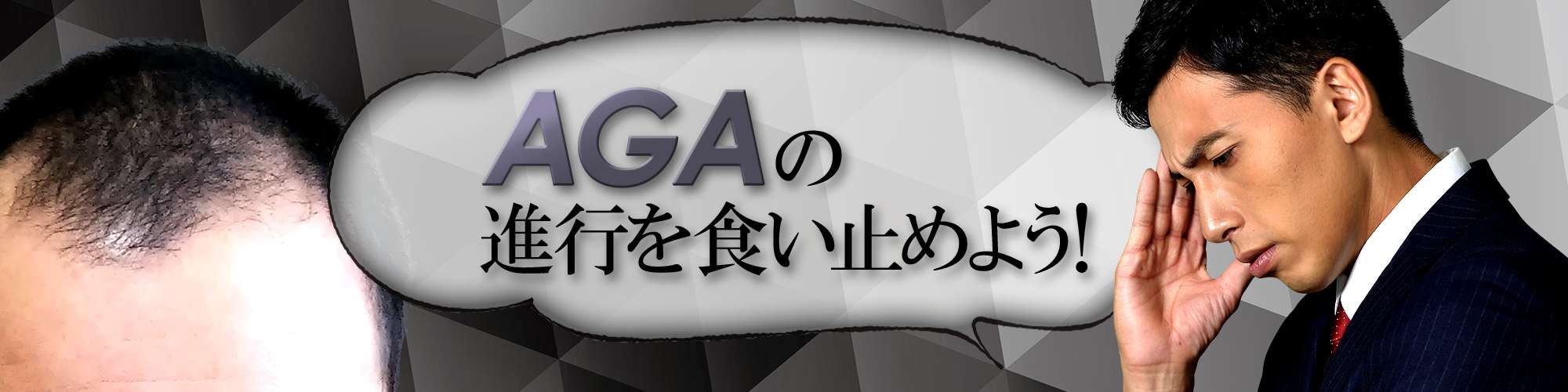AGAの進行を食い止めよう！